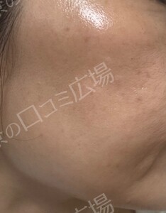 治療前の症例写真