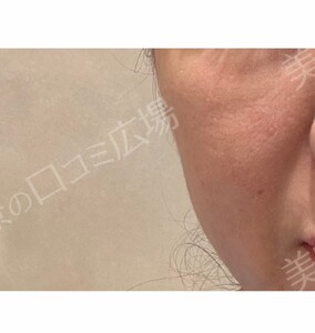 治療前の症例写真