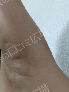 治療結果の症例写真