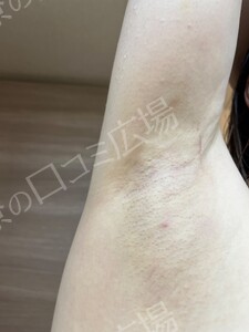治療結果の症例写真