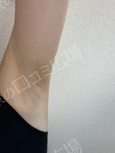 治療前の症例写真
