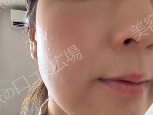 治療結果の症例写真