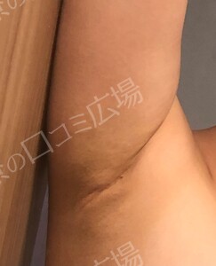 治療結果の症例写真