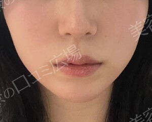 治療結果の症例写真