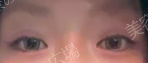 治療前の症例写真