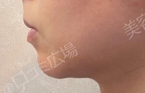 治療前の症例写真