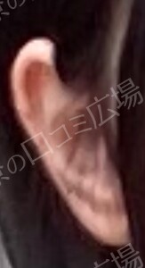 治療前の症例写真