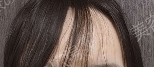 治療前の症例写真