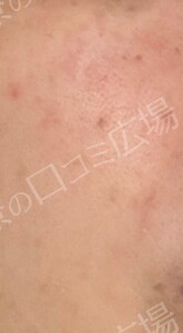 治療前の症例写真