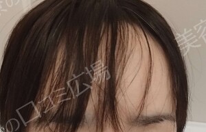 治療前の症例写真