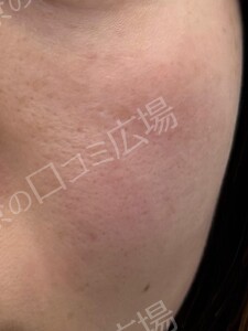 治療前の症例写真