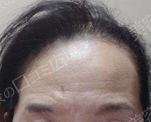 治療結果の症例写真