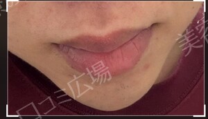 治療前の症例写真