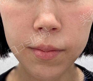 治療前の症例写真