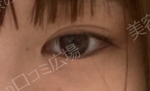 治療前の症例写真