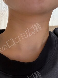 治療結果の症例写真