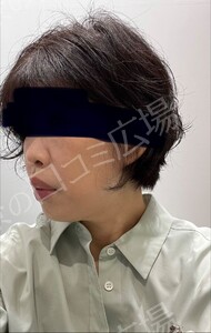 治療結果の症例写真