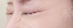 治療前の症例写真