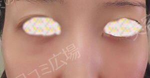 治療結果の症例写真