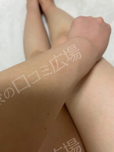 治療前の症例写真