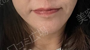 治療前の症例写真