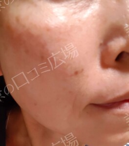 治療結果の症例写真