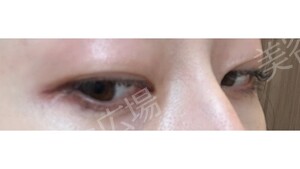 治療前の症例写真