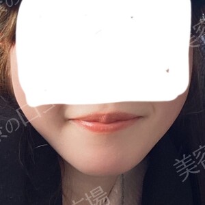 治療前の症例写真