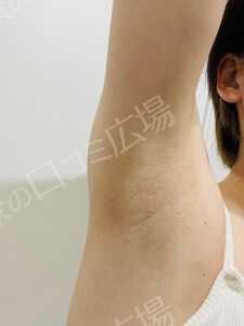 治療前の症例写真