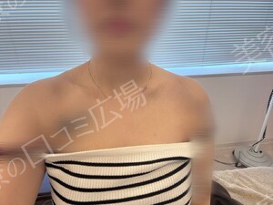 治療直後の症例写真