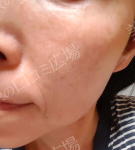 治療結果の症例写真
