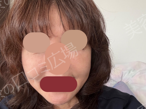 治療前の症例写真