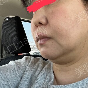 治療前の症例写真