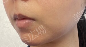 治療結果の症例写真