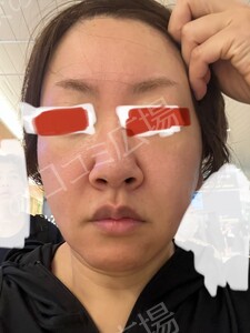 治療結果の症例写真