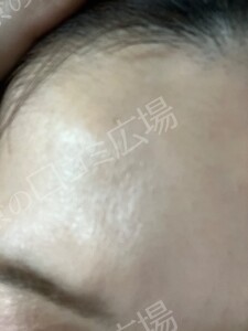 治療結果の症例写真