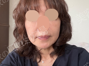 治療前の症例写真