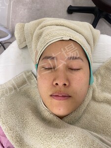 治療前の症例写真