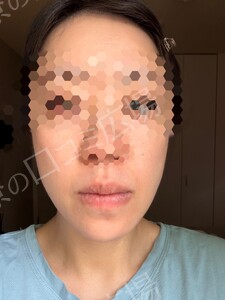 治療結果の症例写真