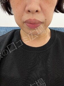 治療前の症例写真