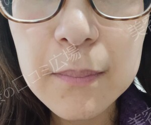 治療結果の症例写真
