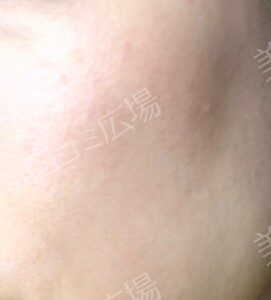 治療結果の症例写真