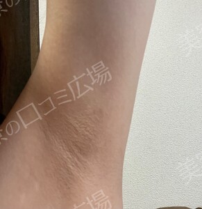 治療結果の症例写真