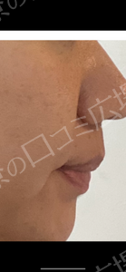 治療結果の症例写真
