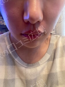 治療前の症例写真