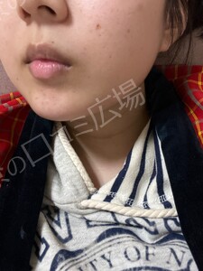 治療結果の症例写真