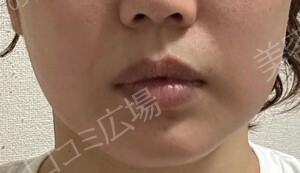 治療結果の症例写真