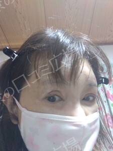 治療前の症例写真