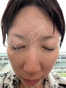 治療結果の症例写真