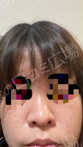 治療前の症例写真